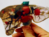 3D-Druck: „Lebensfähige menschliche Organe zu schaffen“