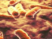 Magenschleimhautentzündung & Sodbrennen: "Mindestens die Hälfte aller Menschen tragen dieses Bakterium in sich"